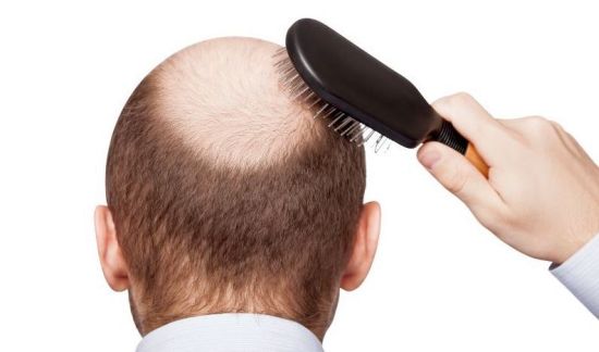 how to regrow thinning hair in front